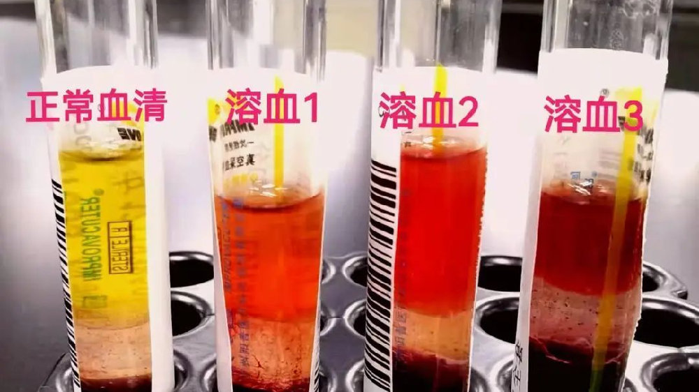 体外溶血实验